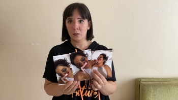 (Özel) Atv Kazasında Gözünü Kaybeden Genç Kadın Adalet Bekliyor
