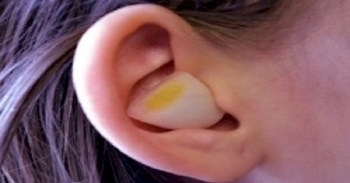 Kulağınıza soğan sokarsanız ne olur