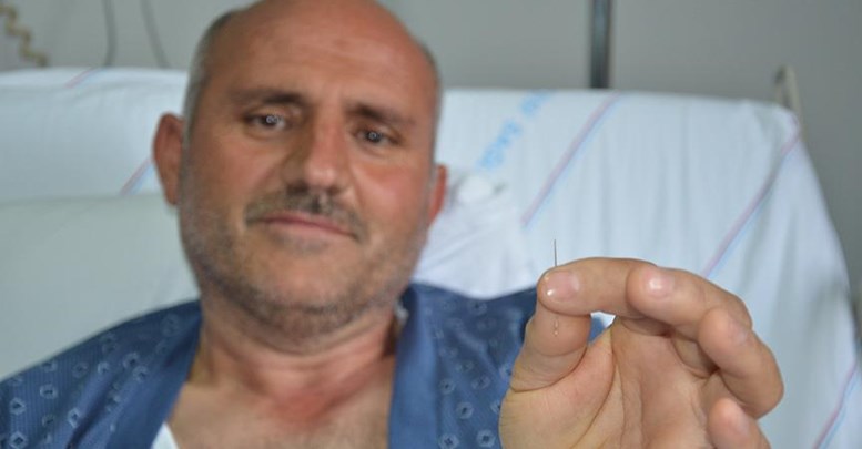 Akciğerinden 'dikiş iğnesi' çıktı