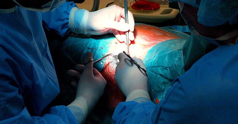 Türler arası organ naklinde ilerleme kaydedildi